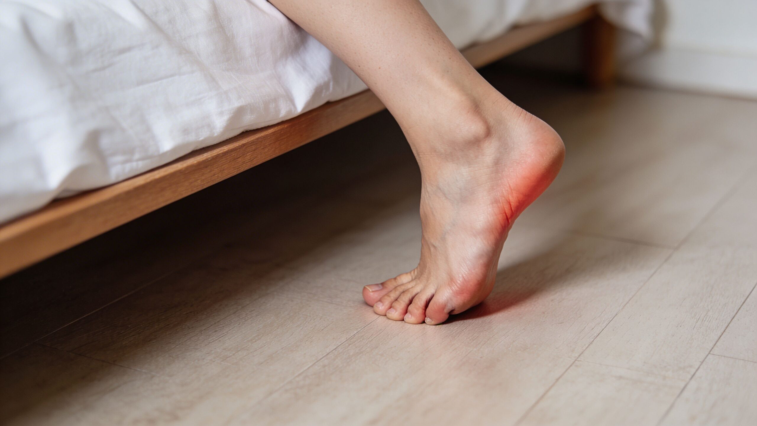 Nærbillede af en kvindes fod der står på gulvet med smerter og rødme i hælen grundet hælspore.