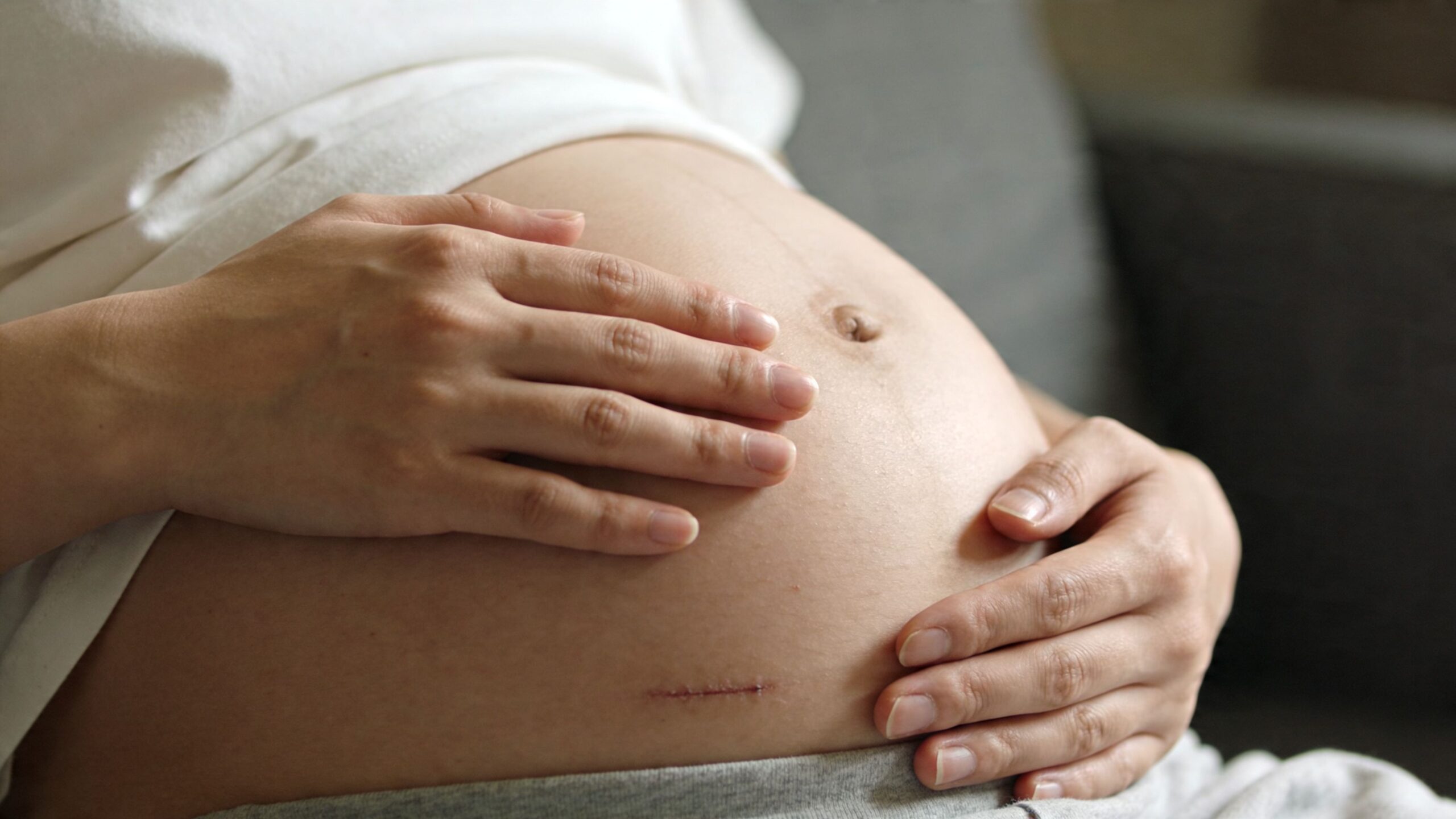 En gravid kvinde holder forsigtigt på sin mave med et tydeligt kejsersnit-ar synligt under hendes hånd.
